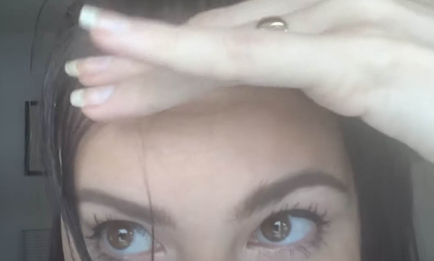  zasto se stvaraju bubuljice u kosi 