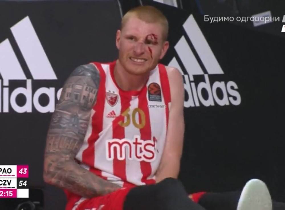  zvezda panatanaikos vajt povreda 