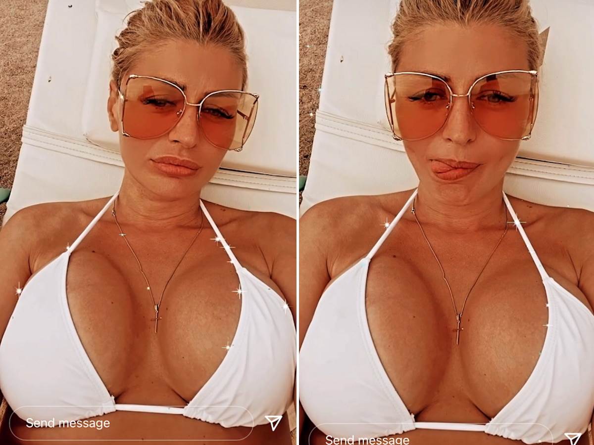  Sandra obradovic silikoni  