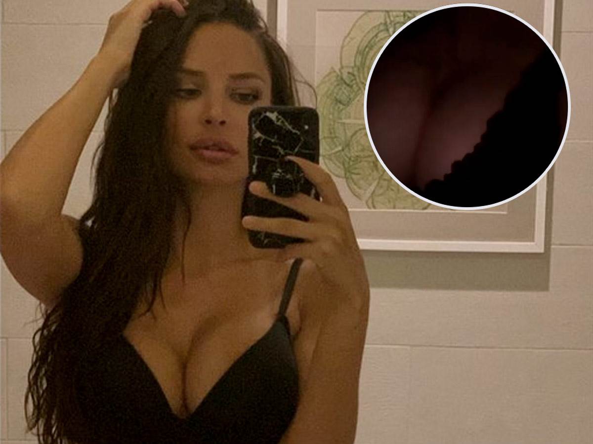  Nataša Šavija silikoni  