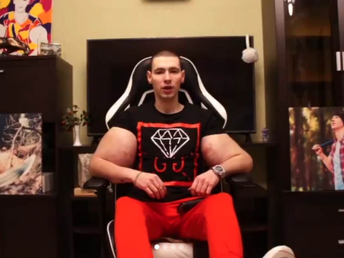  rus mora na operaciju da mu vade zelatin iz misica ruku 