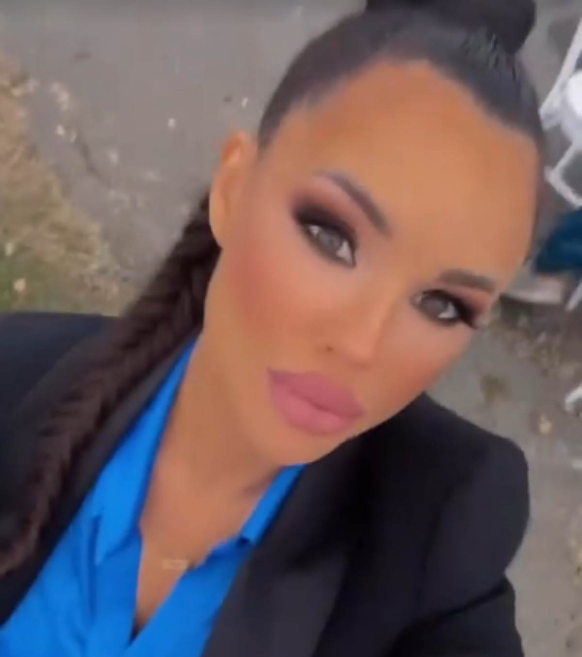  Bojana Rodić prije plastičnih operacija 