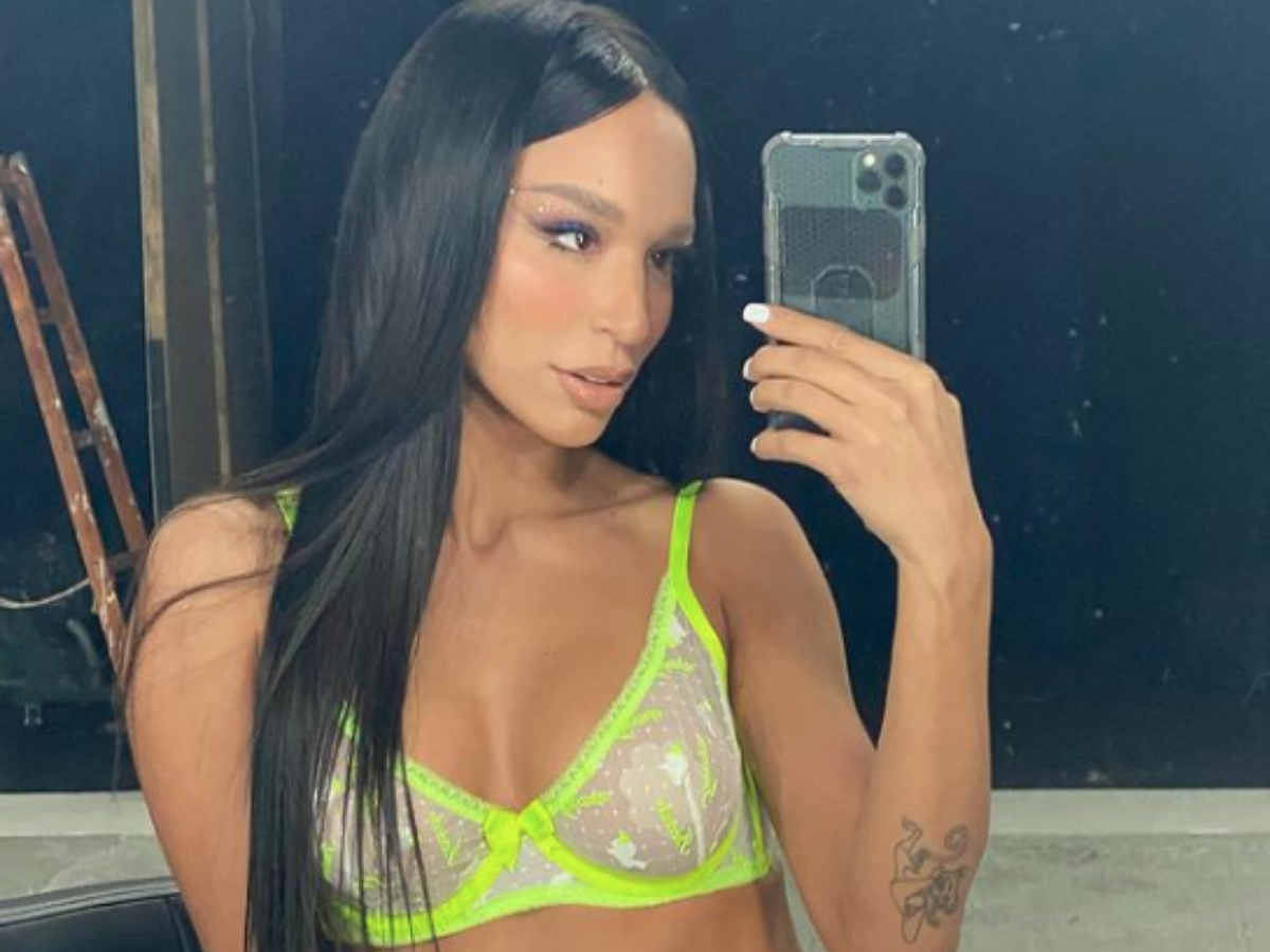  Edita Aradinović o estetskim korekcijama 