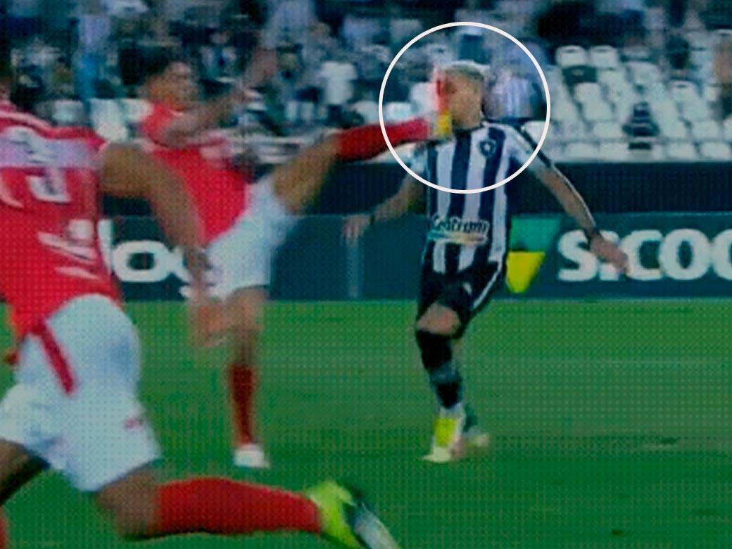  kramponom sijekao lice fudbaleru druga liga brazil fudbal 