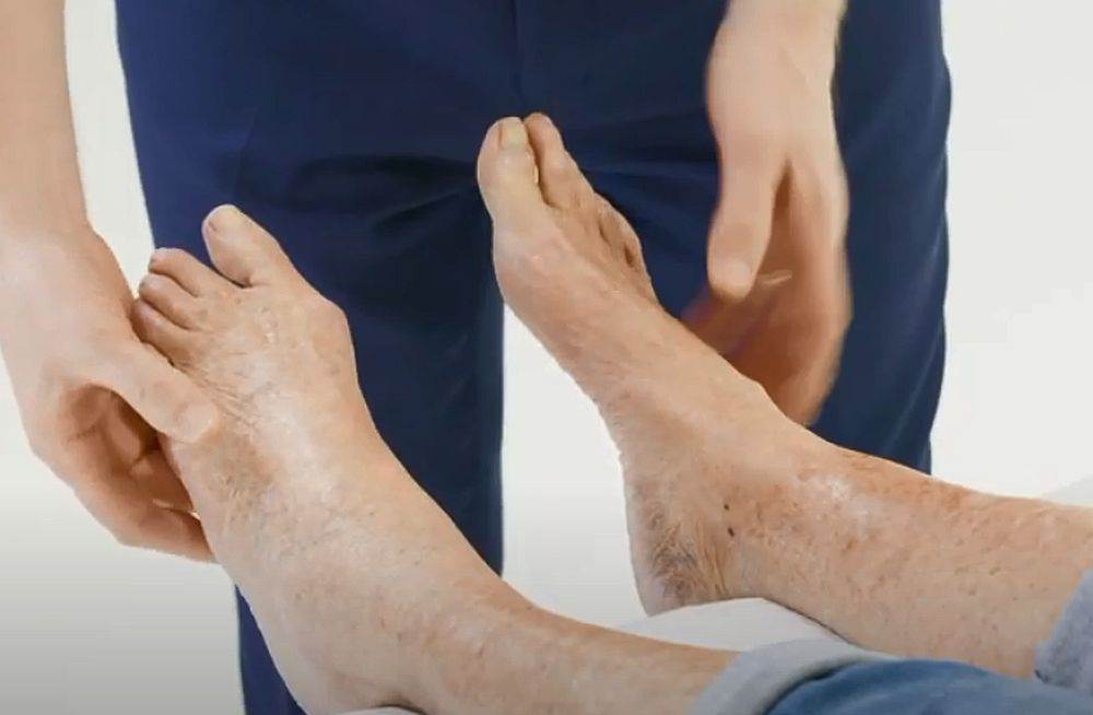  simptomi karcinoma pluca 