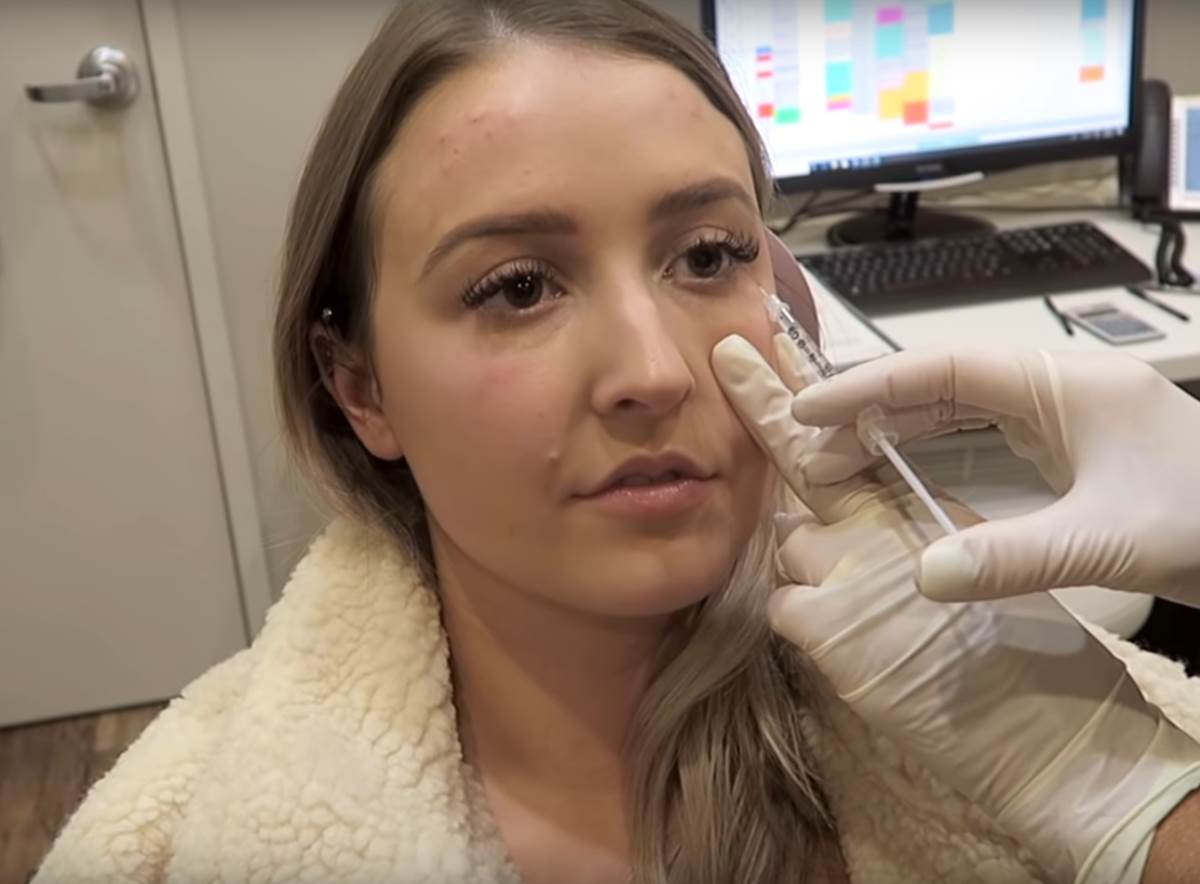  da li poslije botoksa smije da se vakcinise 