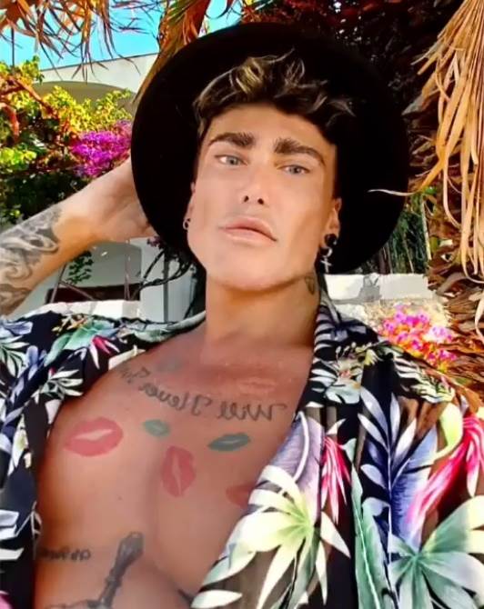  neven ciganovic otklonio silikon 