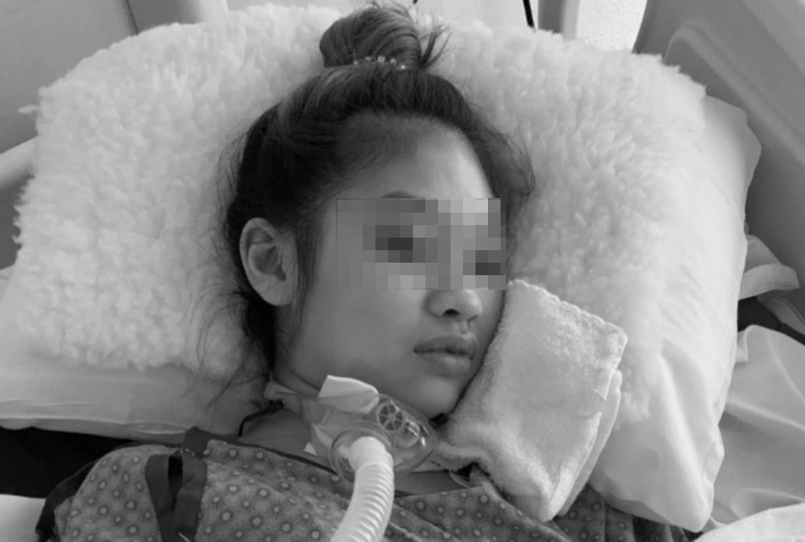  djevojka umrla nakon plasticne operacije 