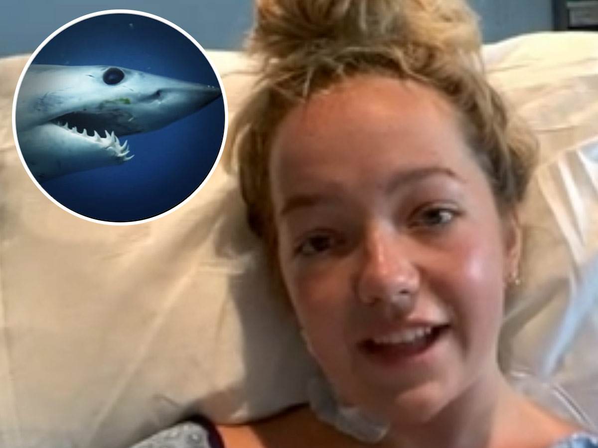  Američka tinejdžerka koja je preživela napad ajkule na plaži u Floridi 