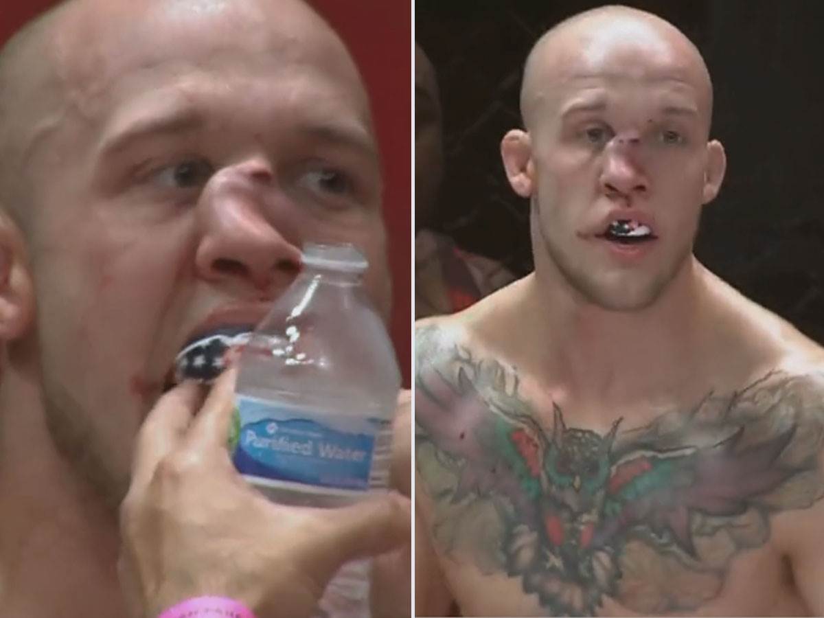  MMA borac Blejk Peri povreda nosa 