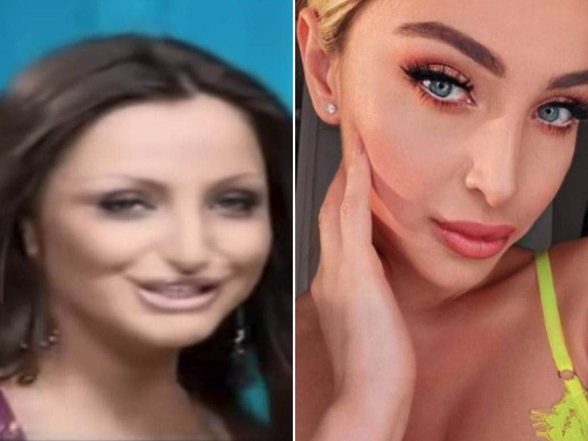 Maja Berović prije i posle operacija 
