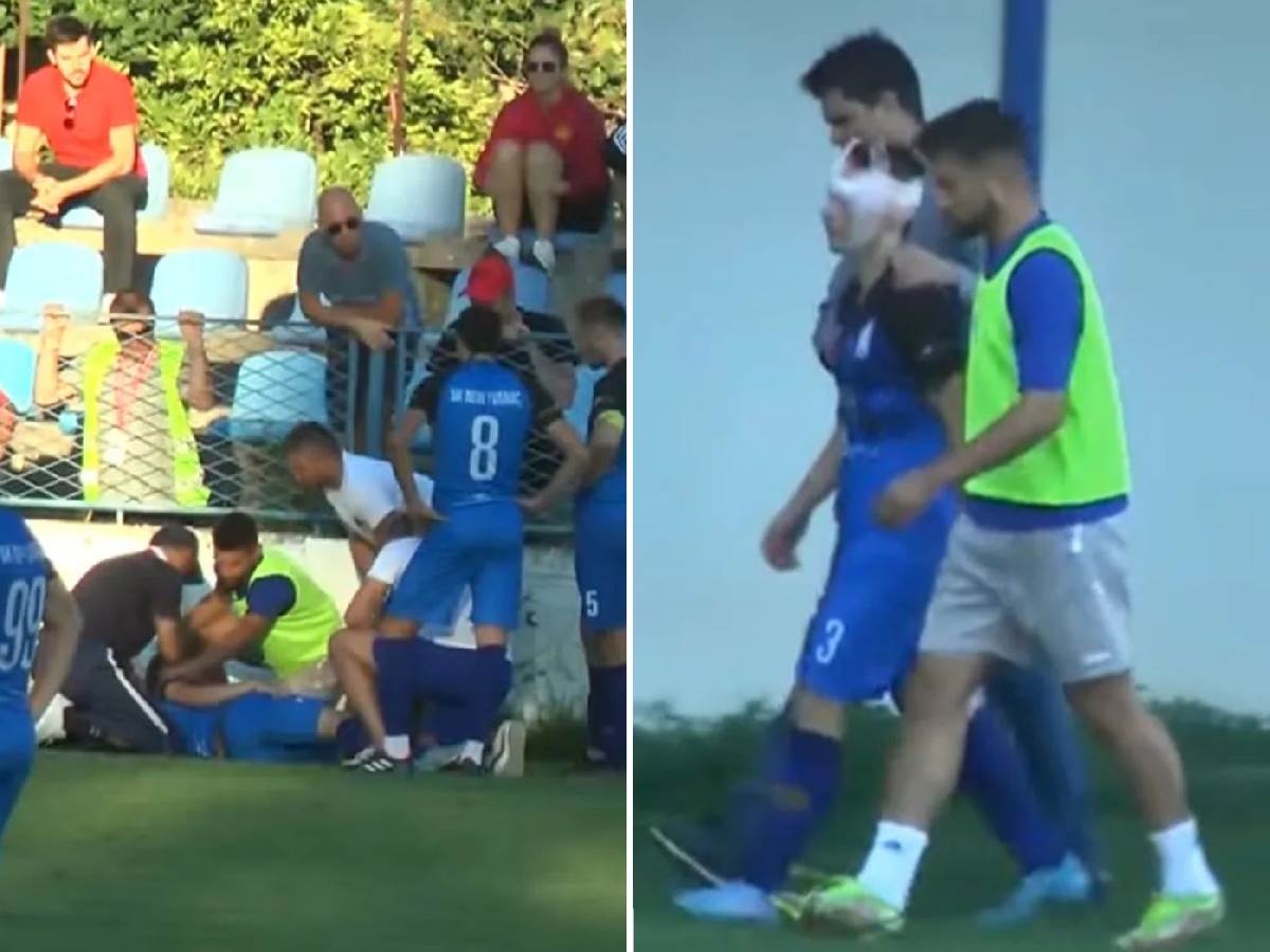  hrvatski fudbaler doživio tešku povredu  