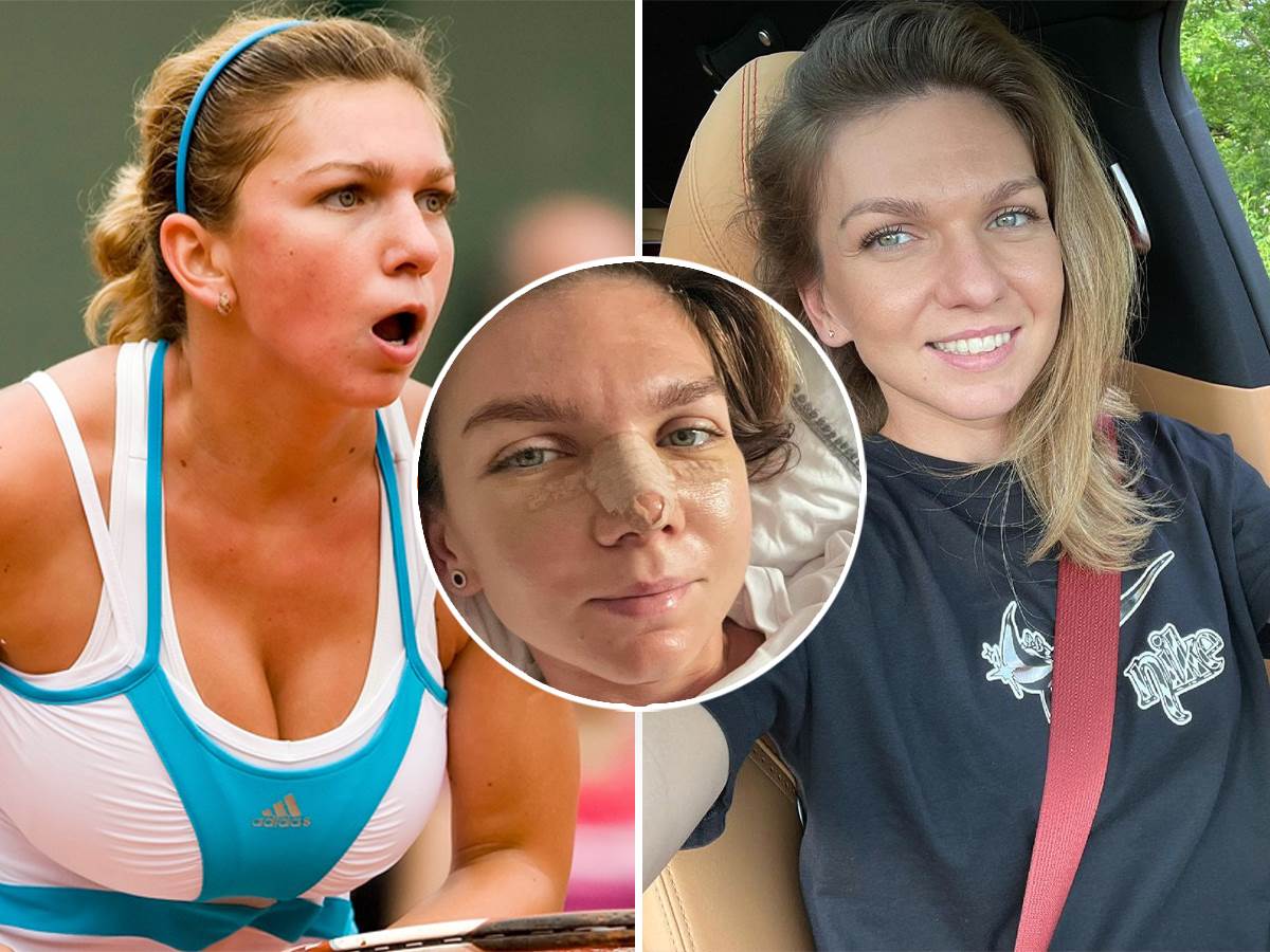  Simona Halep je završila sezonu zbog hirurškog zahvata 