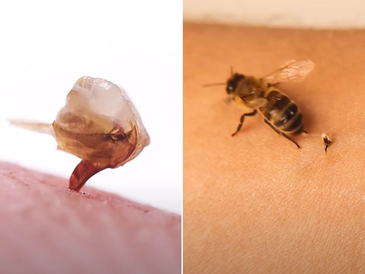  Evo šta se dešava kada vas ubode pčela  