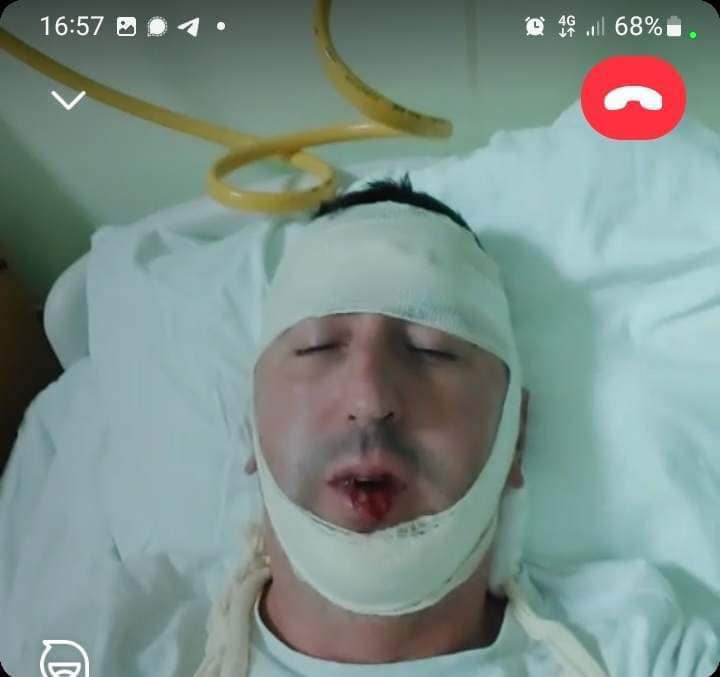  Boško Pavićević teško povrijeđen nakon što su mu napadači tražili da obriše snimak 