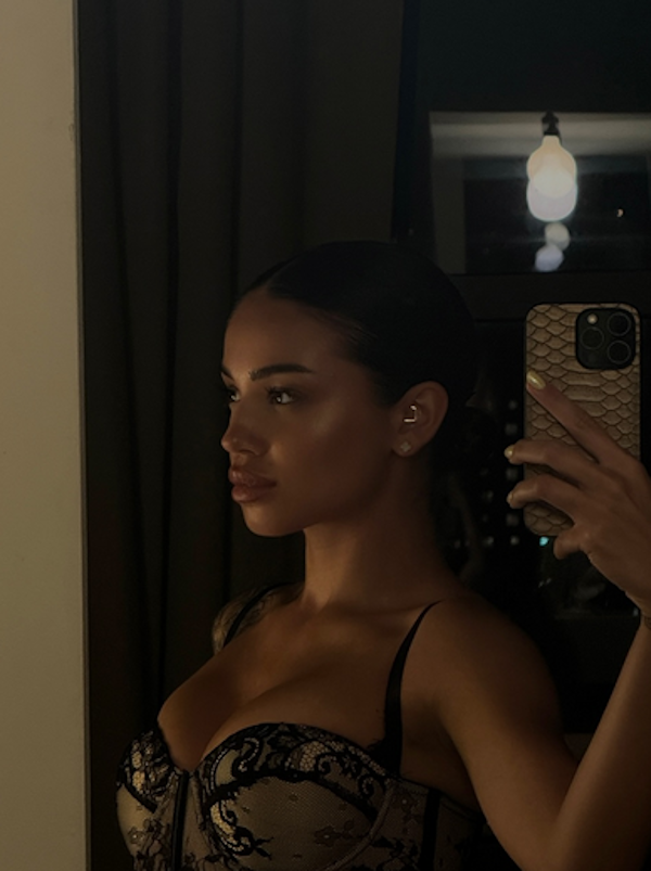  Breskvicu uporedili sa Džej Lo 