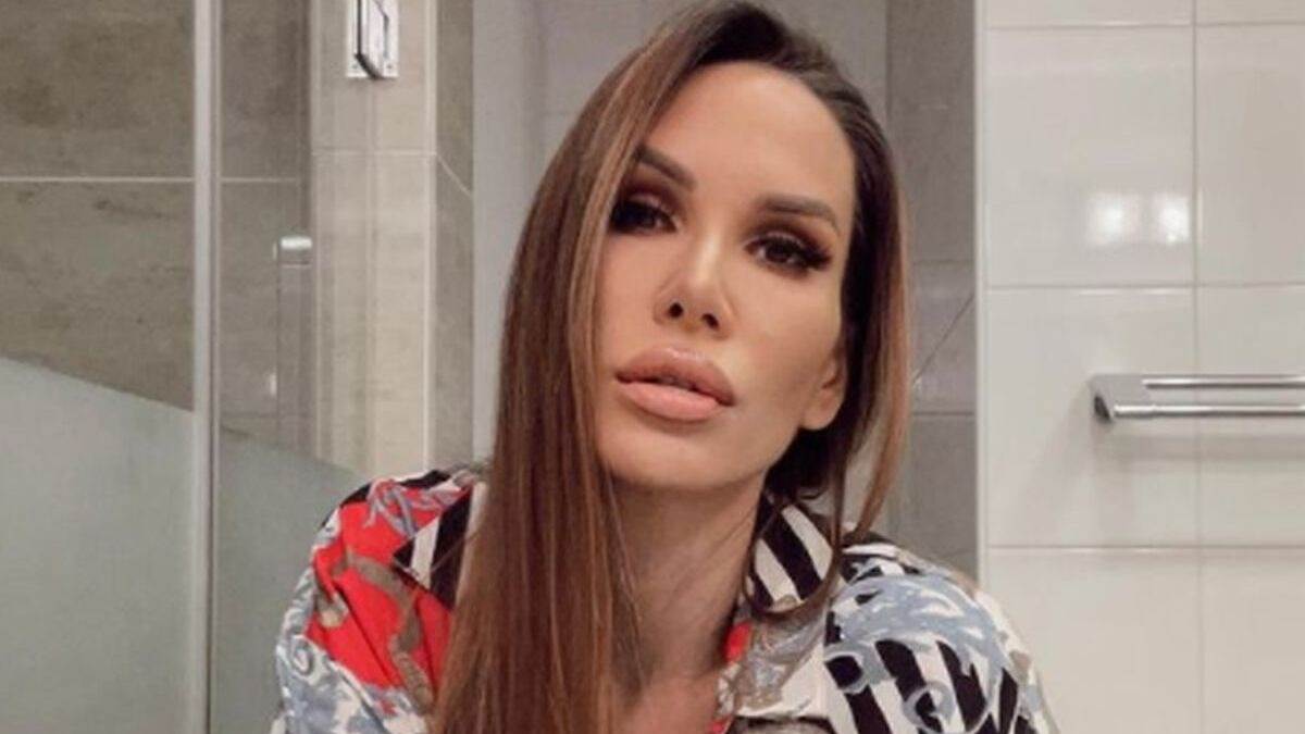  Vesna Zmijanac o Nikolijinim estetskim korekcijama 