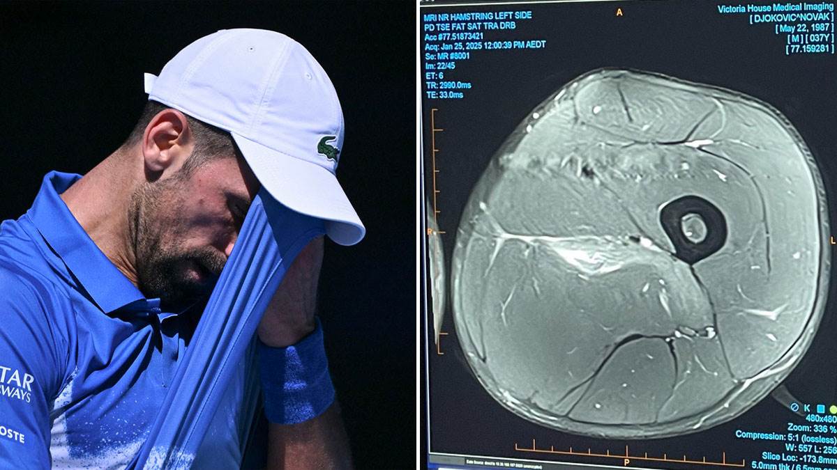  Novak Đoković objavio snimak povrede: Jednim potezom ućutkao sve "eksperte" 