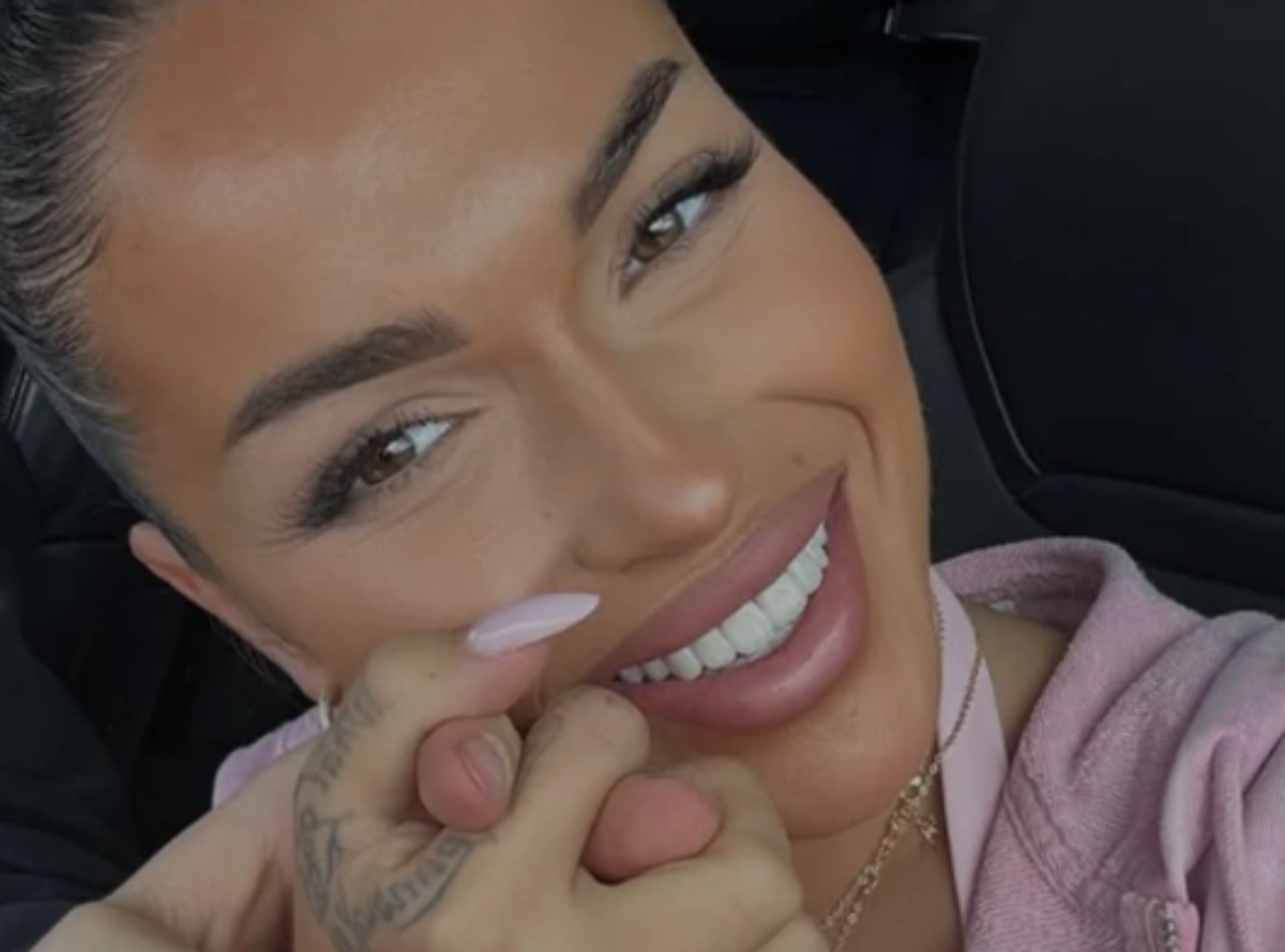  Prvu estetsku intervenciju uradila u 16: Teodora Džehverović otkrila šta je sve operisala na sebi (F 