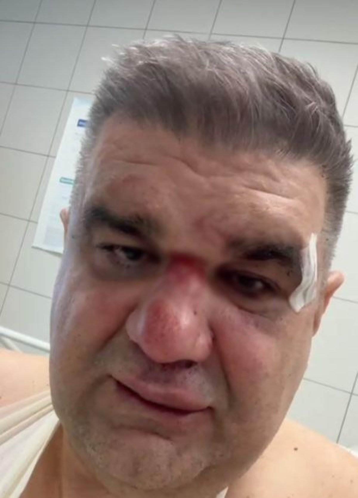  Saša Mirković mora na hitnu operaciju 