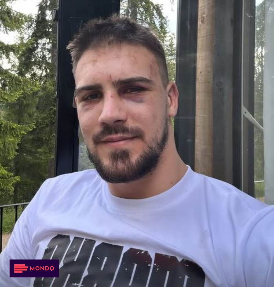 Marko Bojković objavio kako izgleda poslije žestokih batina | Sport ...