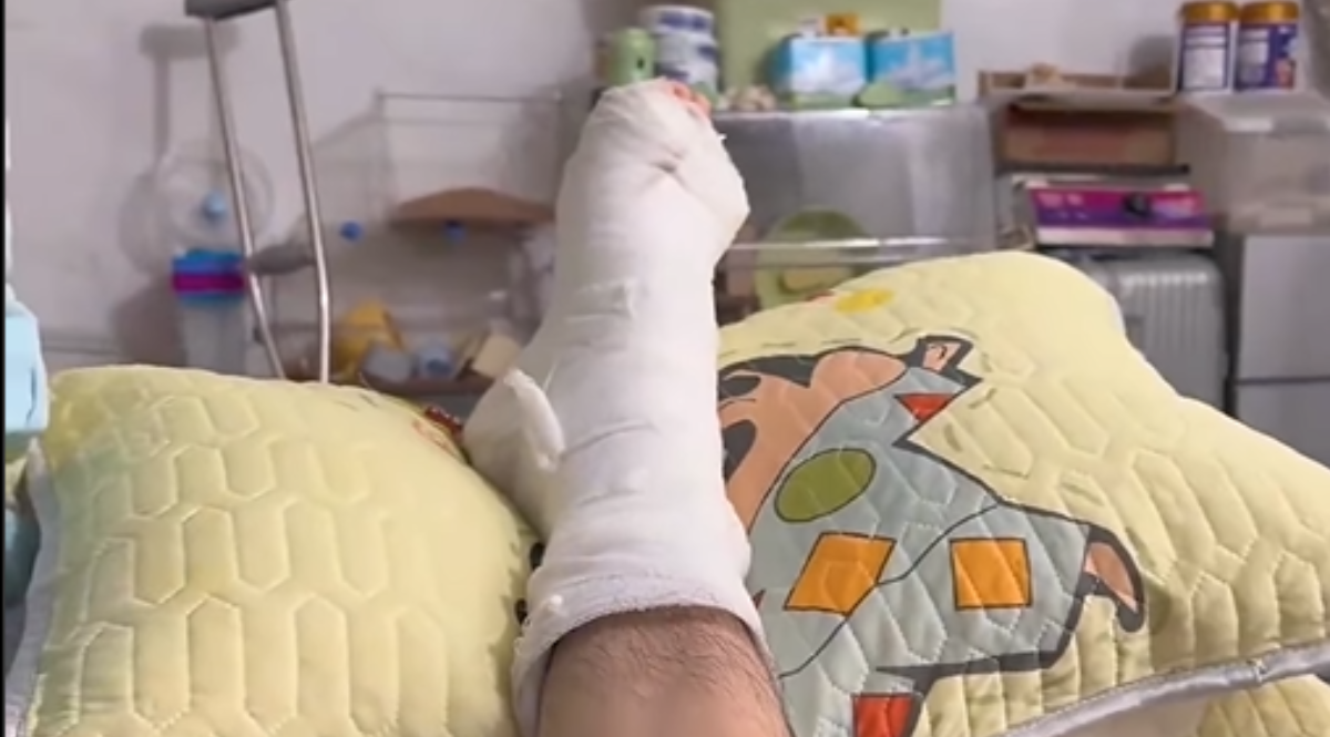  Slomio je nogu, a onda je ostao u šoku kada je vidio šta radi njegov hrčak 