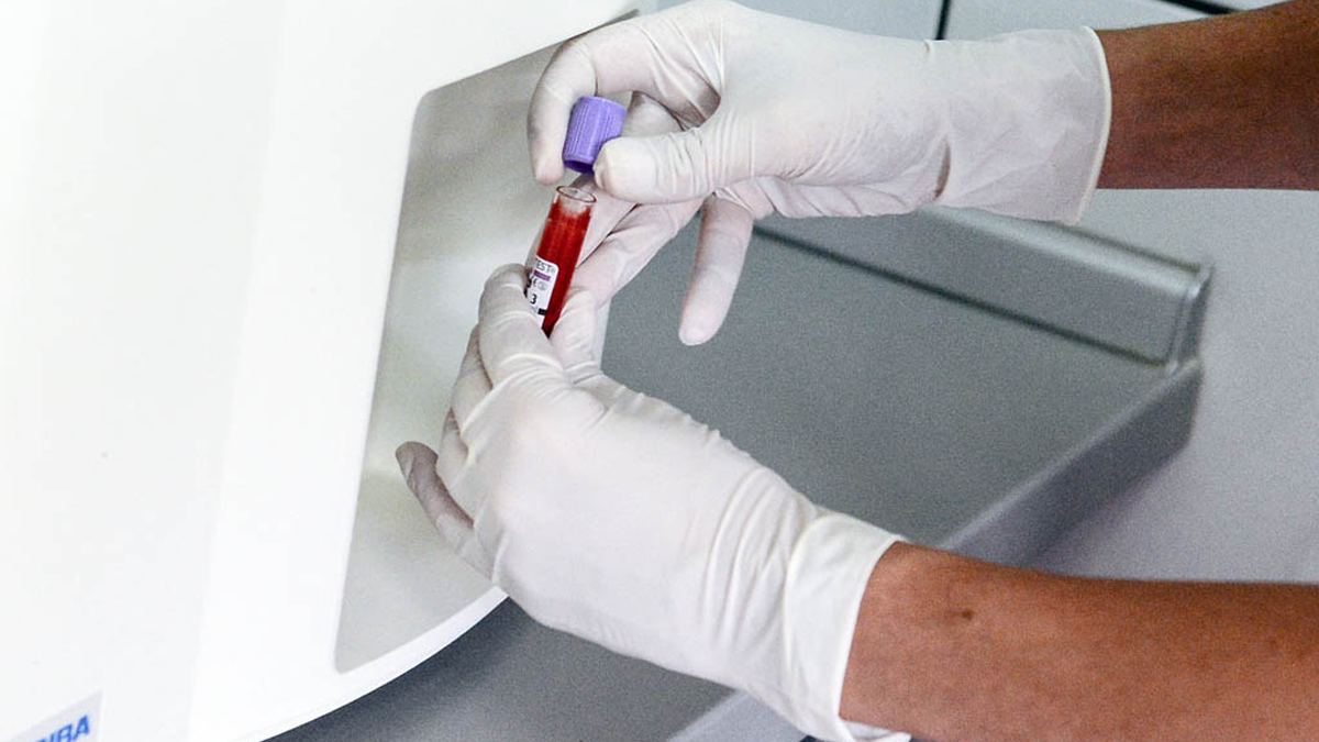  Ljudi sa ovom krvnom grupom žive najduže? 