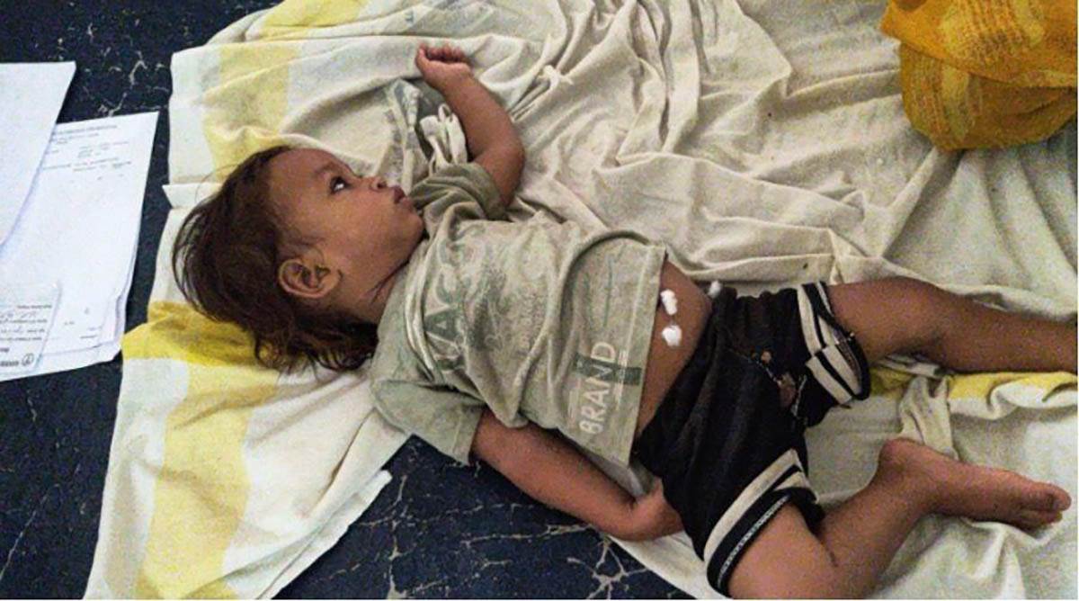  Jednogodišnji dječak ugrizao otrovnu kobru i ubio je 