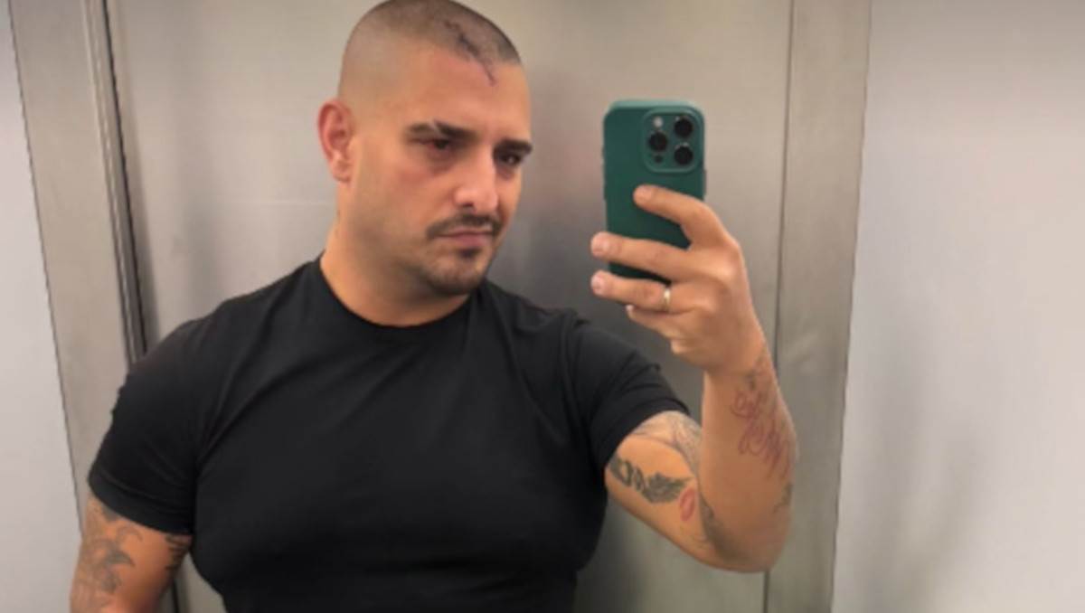  Darko prošetao šavove nakon saobraćajke: Već imao prvi nastup sa sve rezovima na glavi 