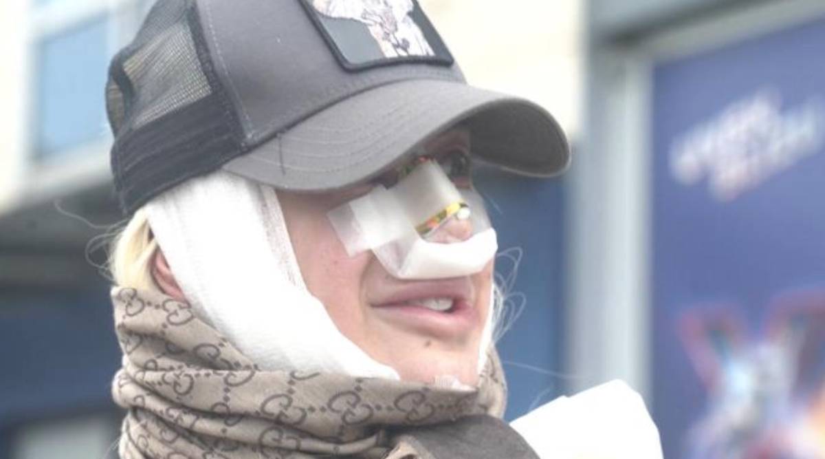  Voditeljka Dušica Jakovljević otkrila je da će sedmi put morati da operiše nos 