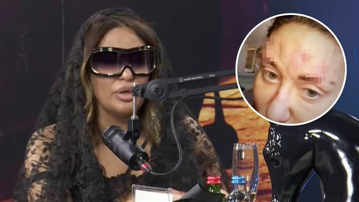  Ana Nikolić posjetila gataru zbog rana na licu  