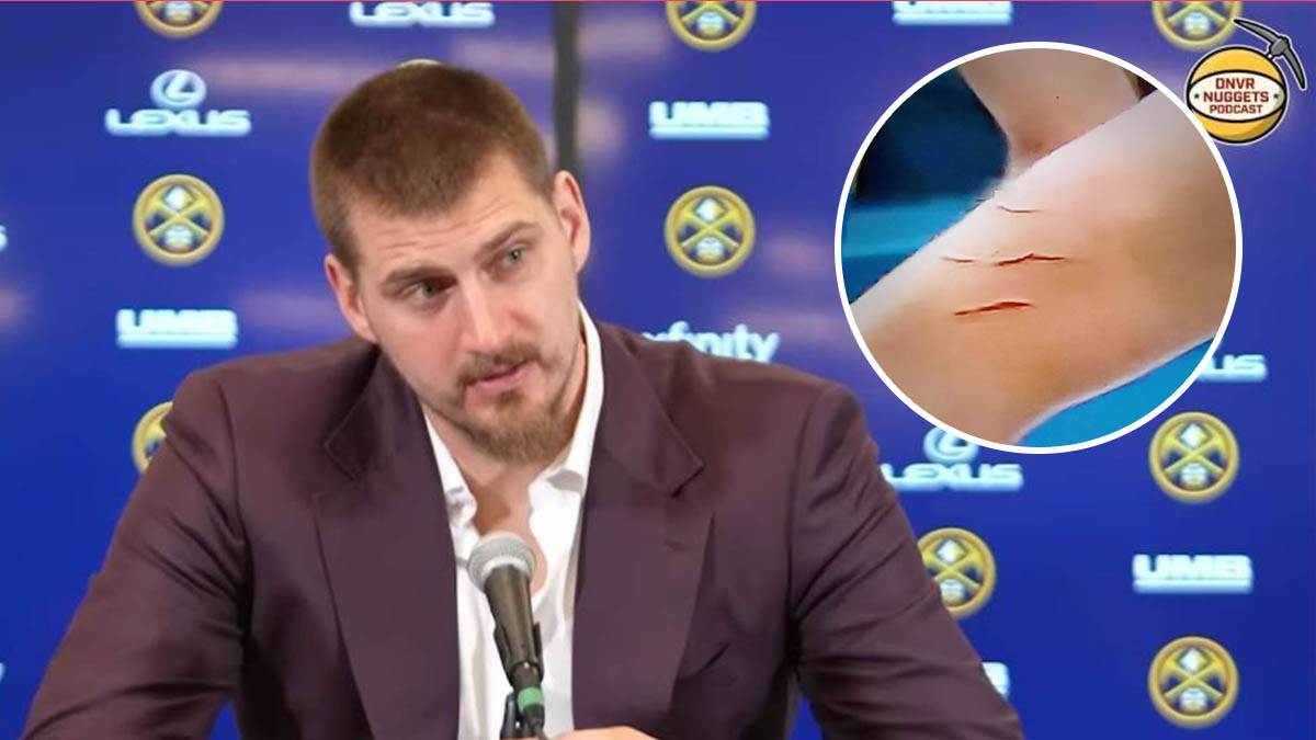  Jokić krvav i izranjavan, a sudije ćute 