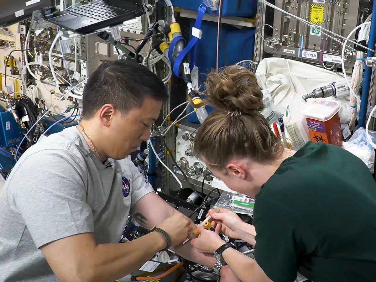  Kako izgleda vađenje krvi bez gravitacije 