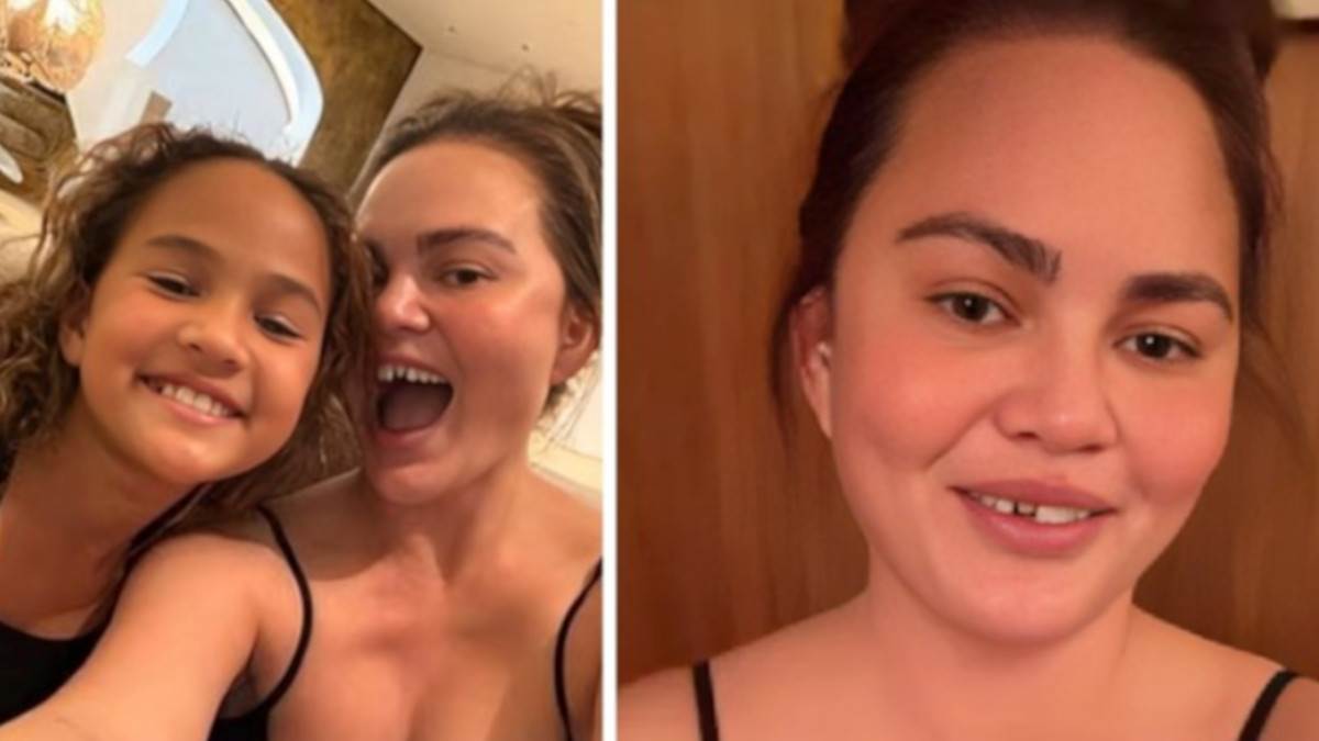  Krisi Tajgen ostala bez zuba  