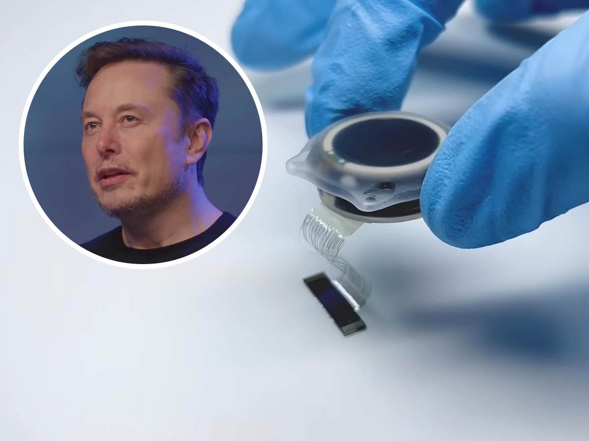  Neuralink pred velikim iskorakom 