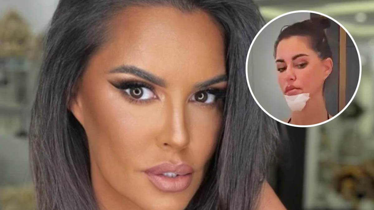  "Polomila sam vilicu, modrice svuda, ne mogu da pričam": Prve fotografije Dijane Dilajn nakon nezgod 