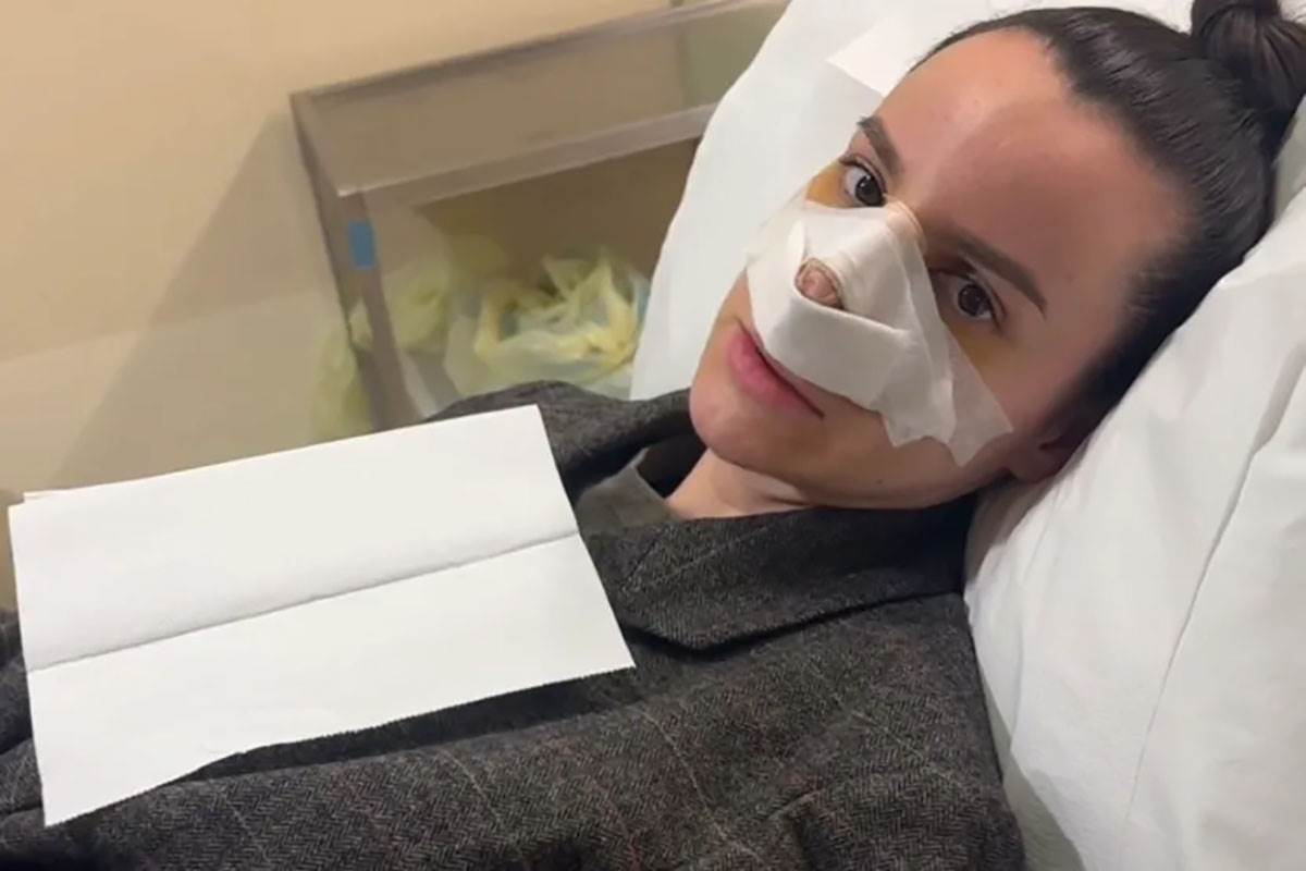  Tatjana Pejčić nezadovoljna operacijom nosa  