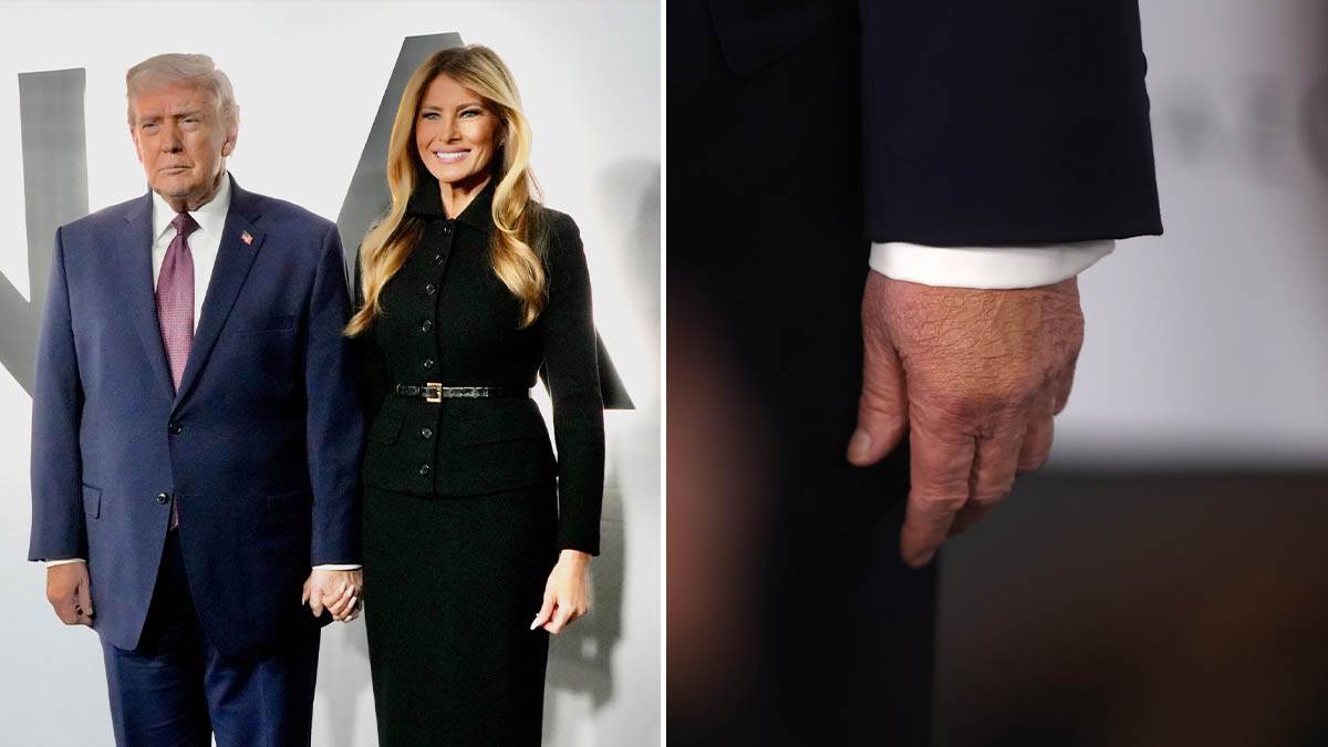  Ruka Donalda Trampa izaziva zabrinutost 