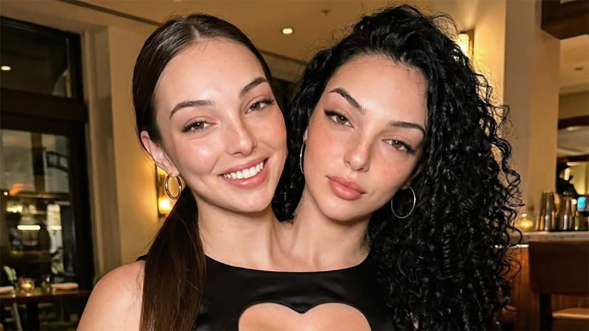  "Da li ste vi uopšte prave?!": Ljudi ne veruju koliko su sijamske bliznakinje lepe, stručnjak sve ra 