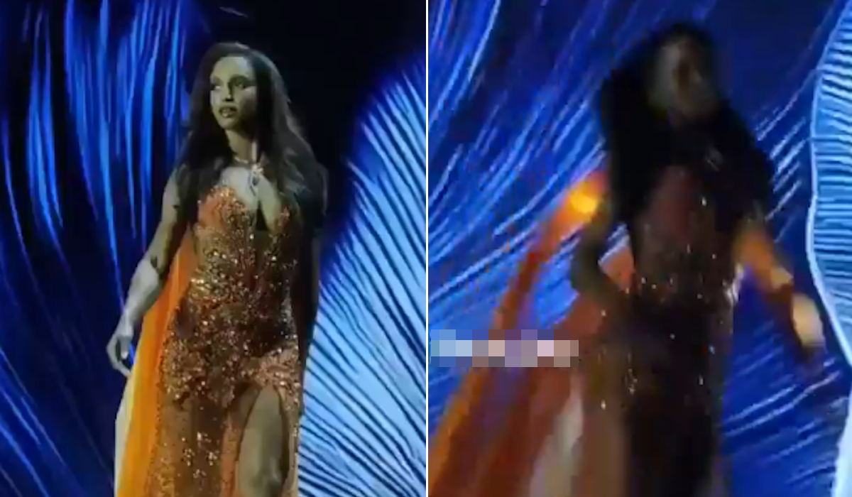  Misica koja je zadobila teške povrede glave objavila slike iz bolnice 