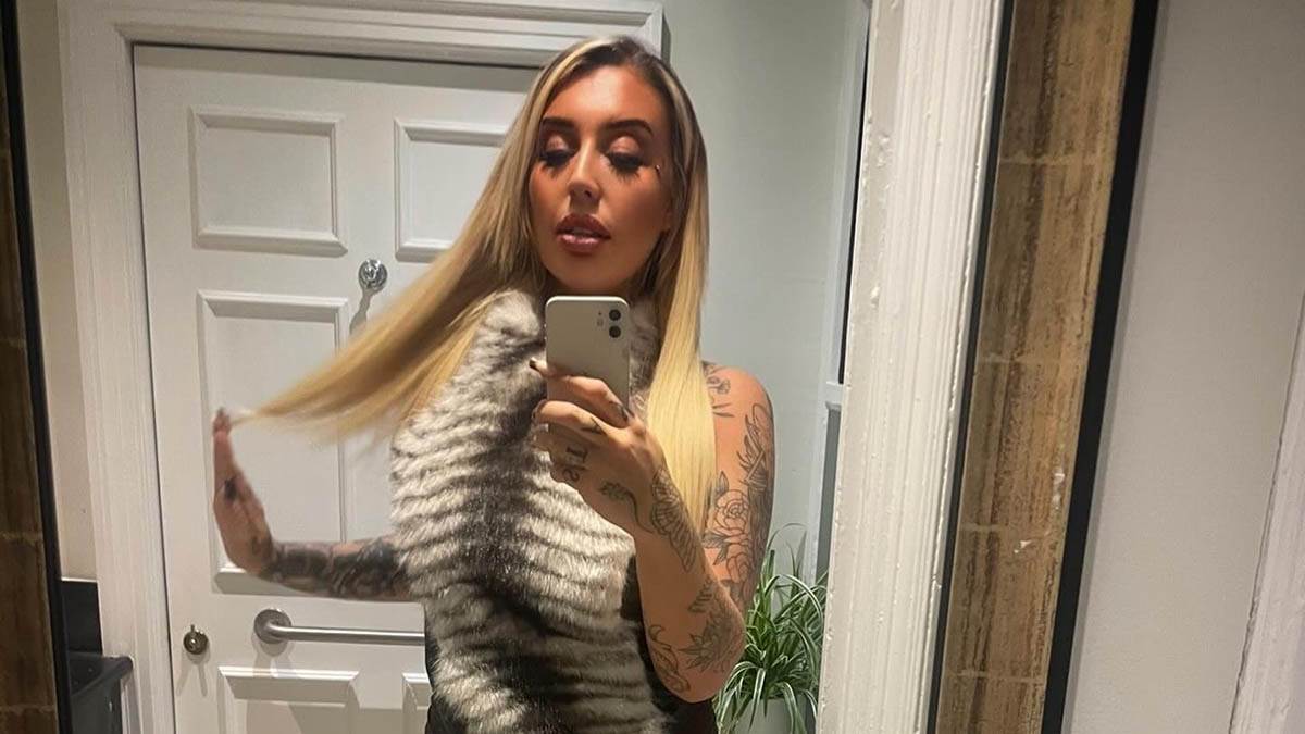  Influenserka pala s balkona hotela: Slomila kičmu na 24 mjesta, a ruke joj potpuno uništene 