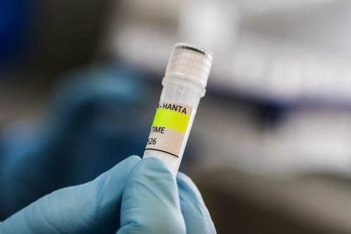  Hantavirus stigao u Evropu?! Stuardesa u izolaciji, bila u kontaktu sa ženom koja se srušila na aero 