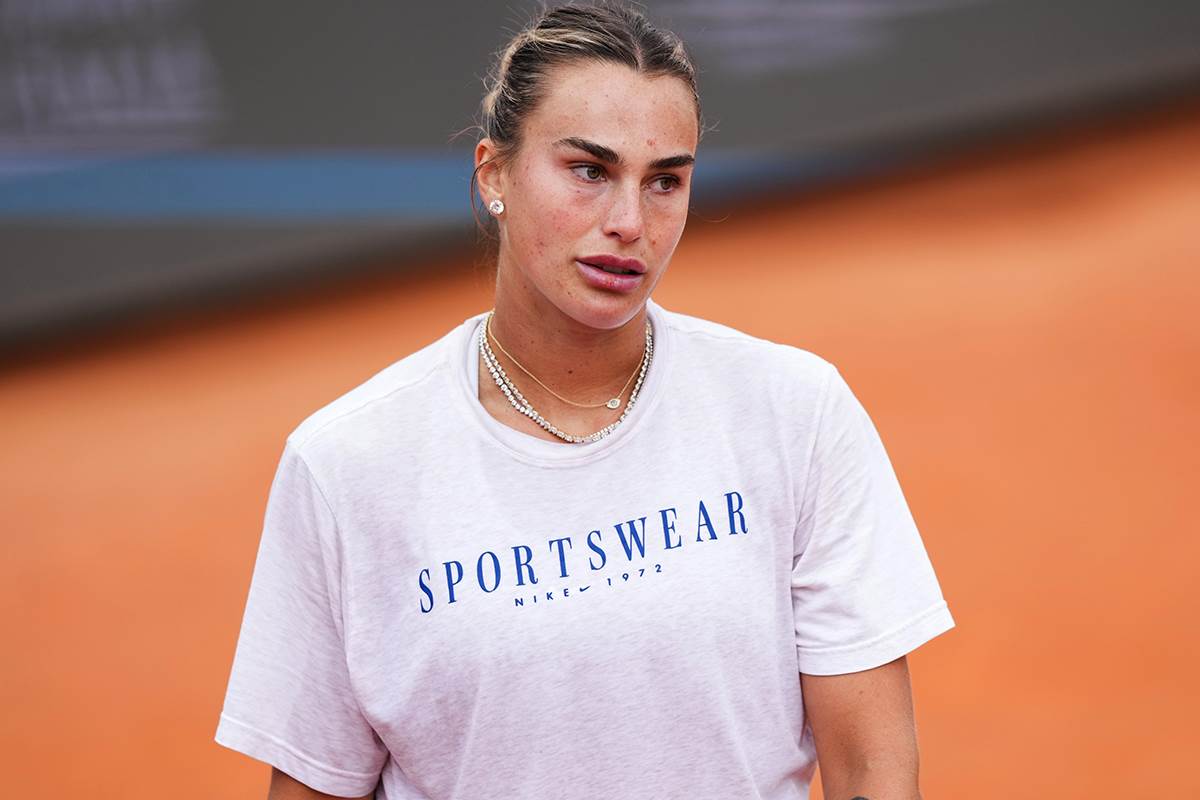  Da li je Arina Sabalenka pretjerala s filerima u usnama? 