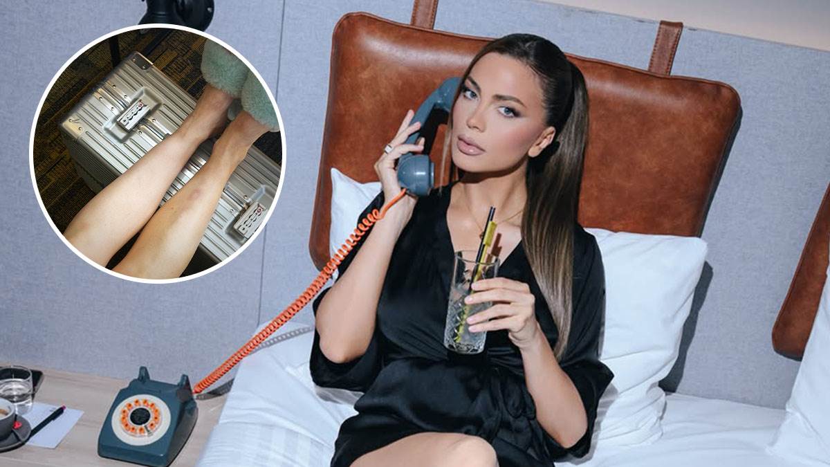  Milica Pavlović u podlivima i modricama 