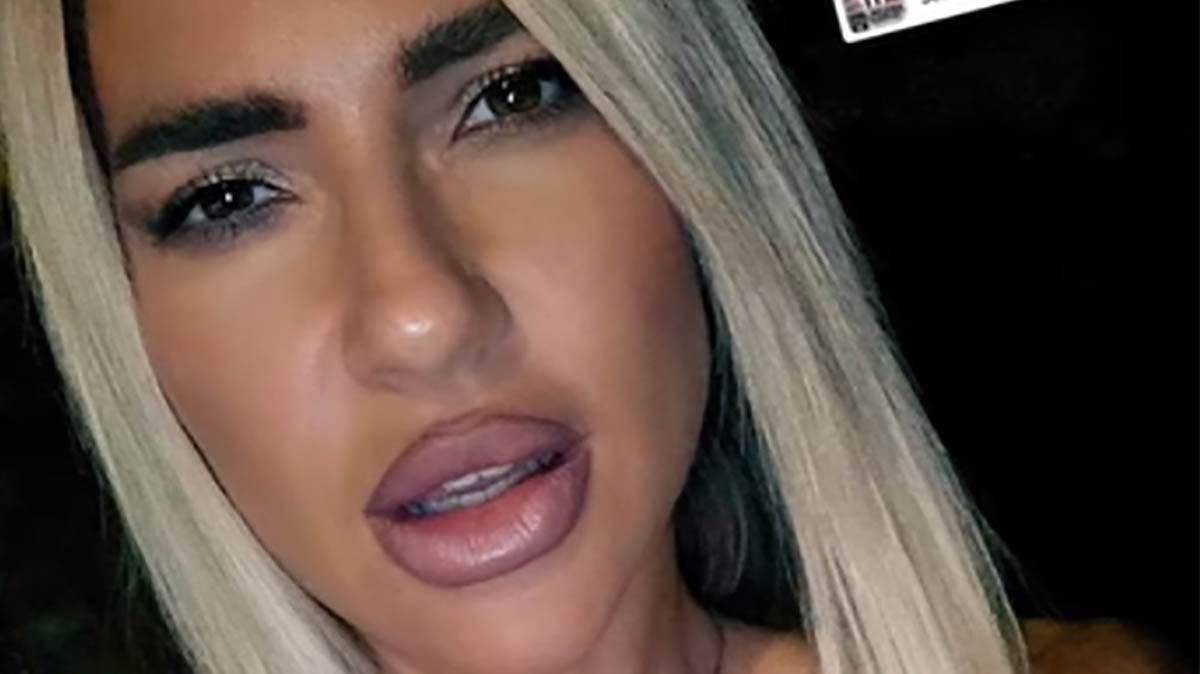  Jovana Jeremić ne miruje ni sekunde: Nakon teške operacije izašla na ulicu u brusu, kamere sve zabil 
