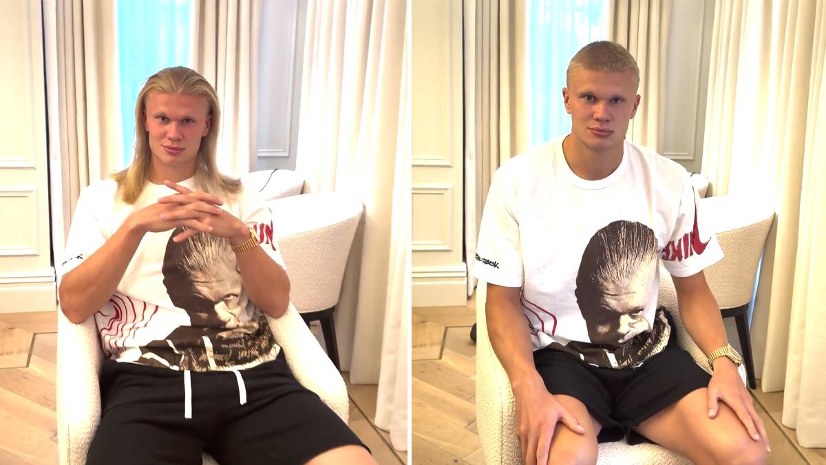  Erling Haland više ne izgleda isto 
