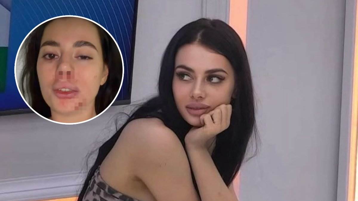  Prvo oglašavanje teško pretučene rijaliti učesnice: Ivana sva u modricama, javno upozorila djevojke 