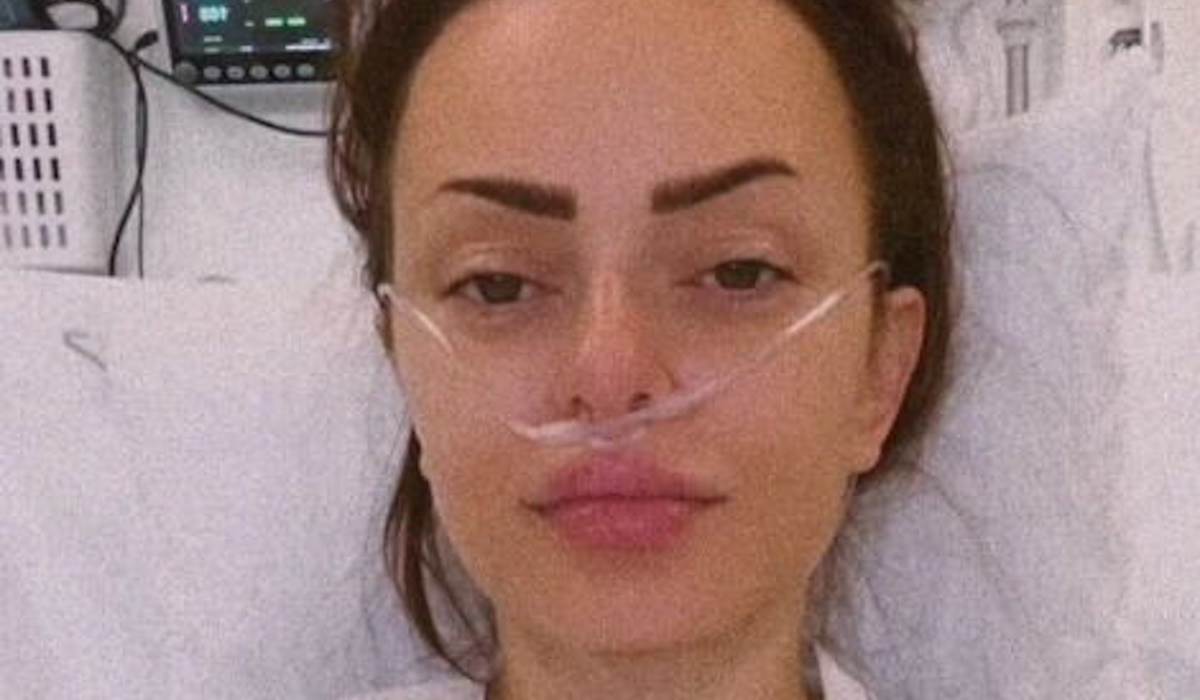  Jeleni Batos izvadili tumor iz glave 
