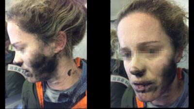  Apple krivi baterije za eksplodirajuće slušalice 