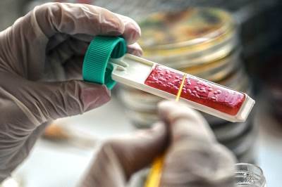  HIV-lecenje-HIV-virusa 